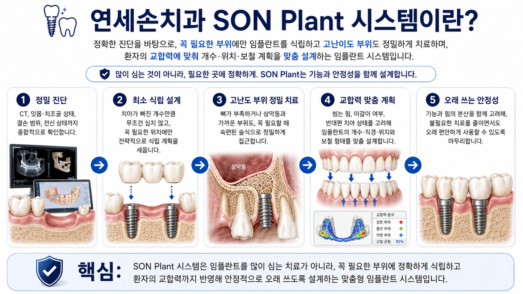 S.O.N Plant 시스템