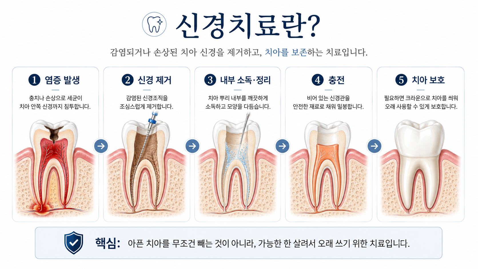 신경치료