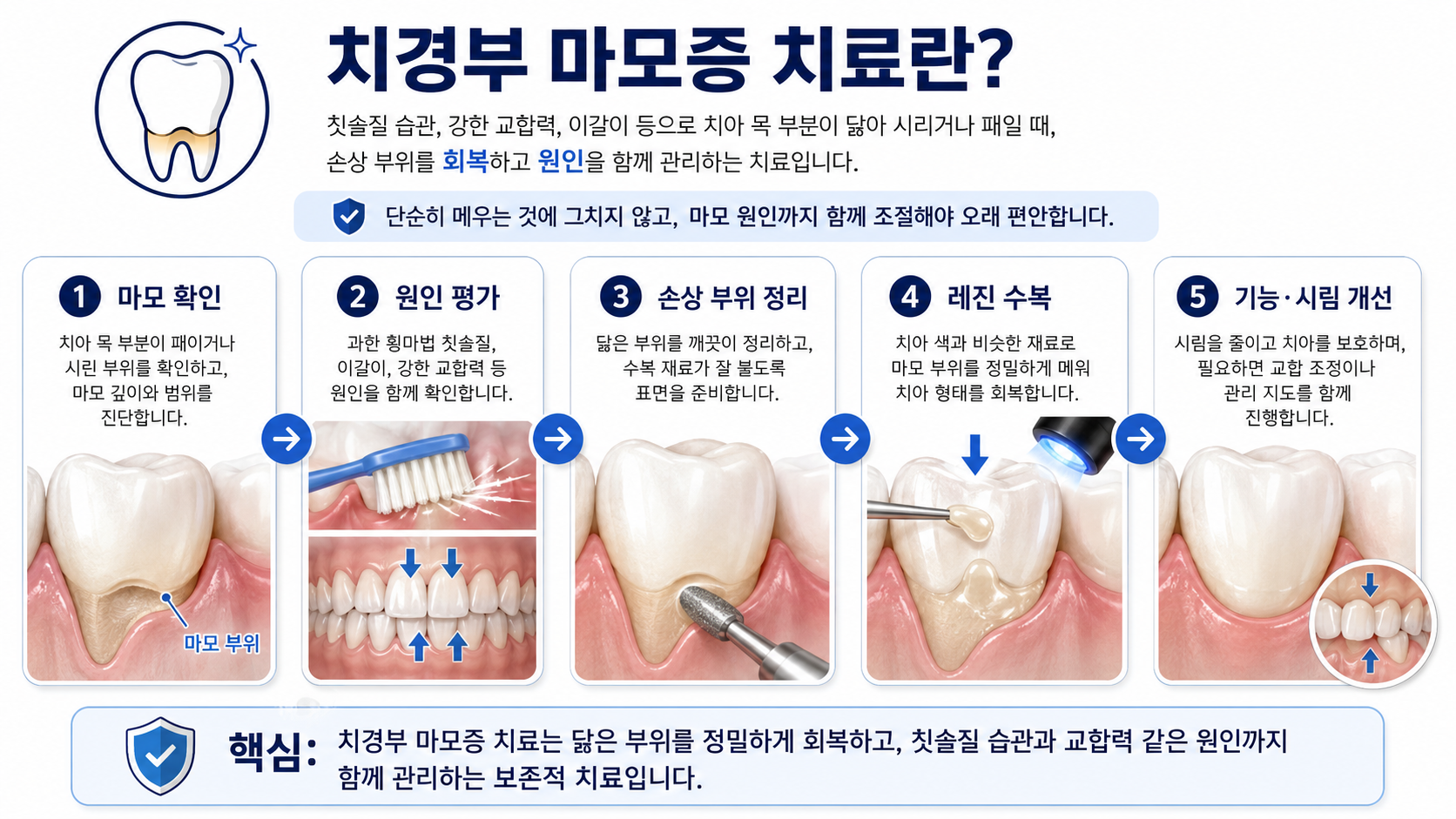 치경부 마모