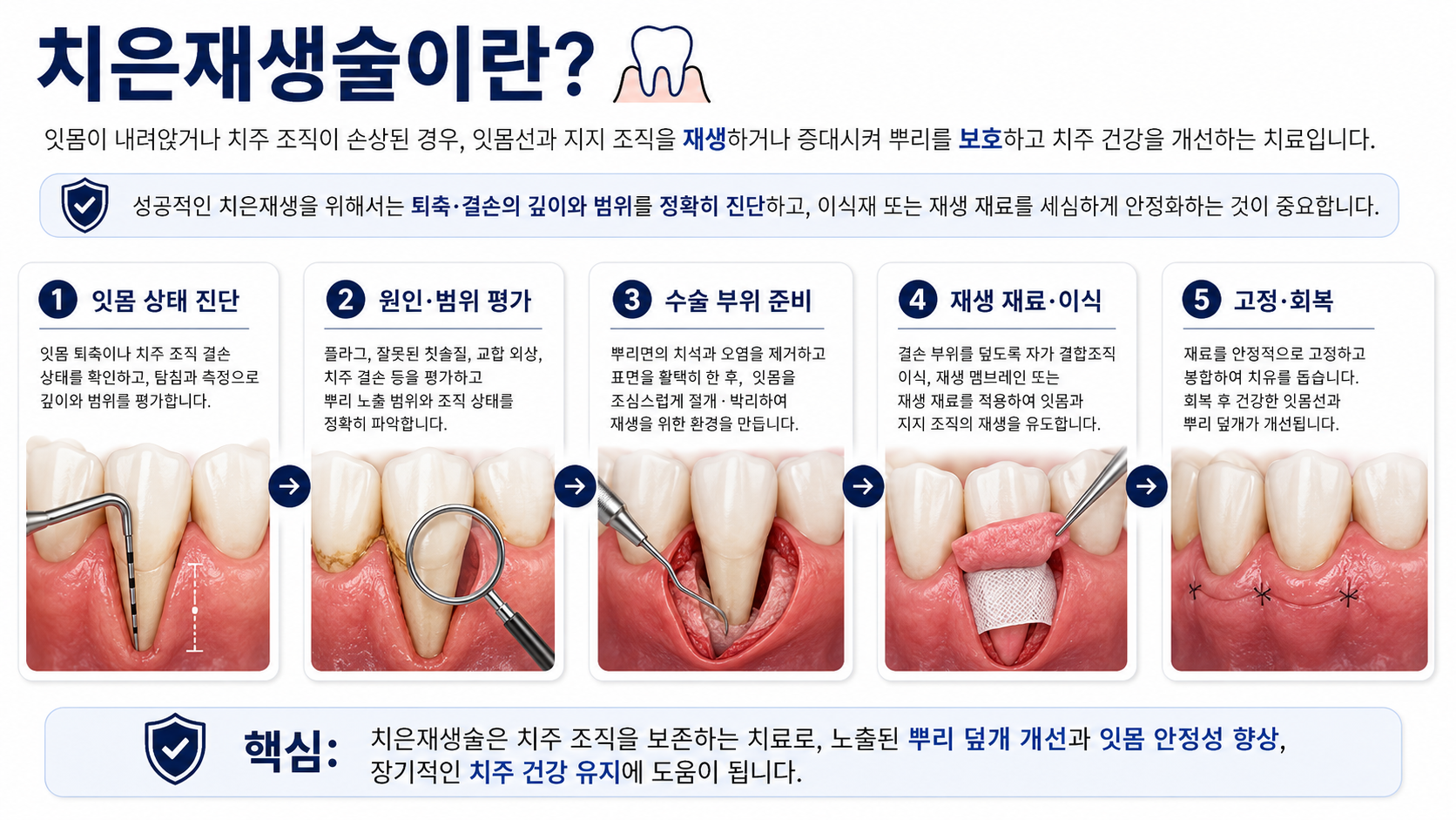 치은재생술